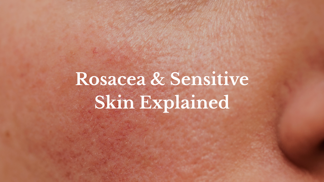 Rosacea & Sensitive Skin