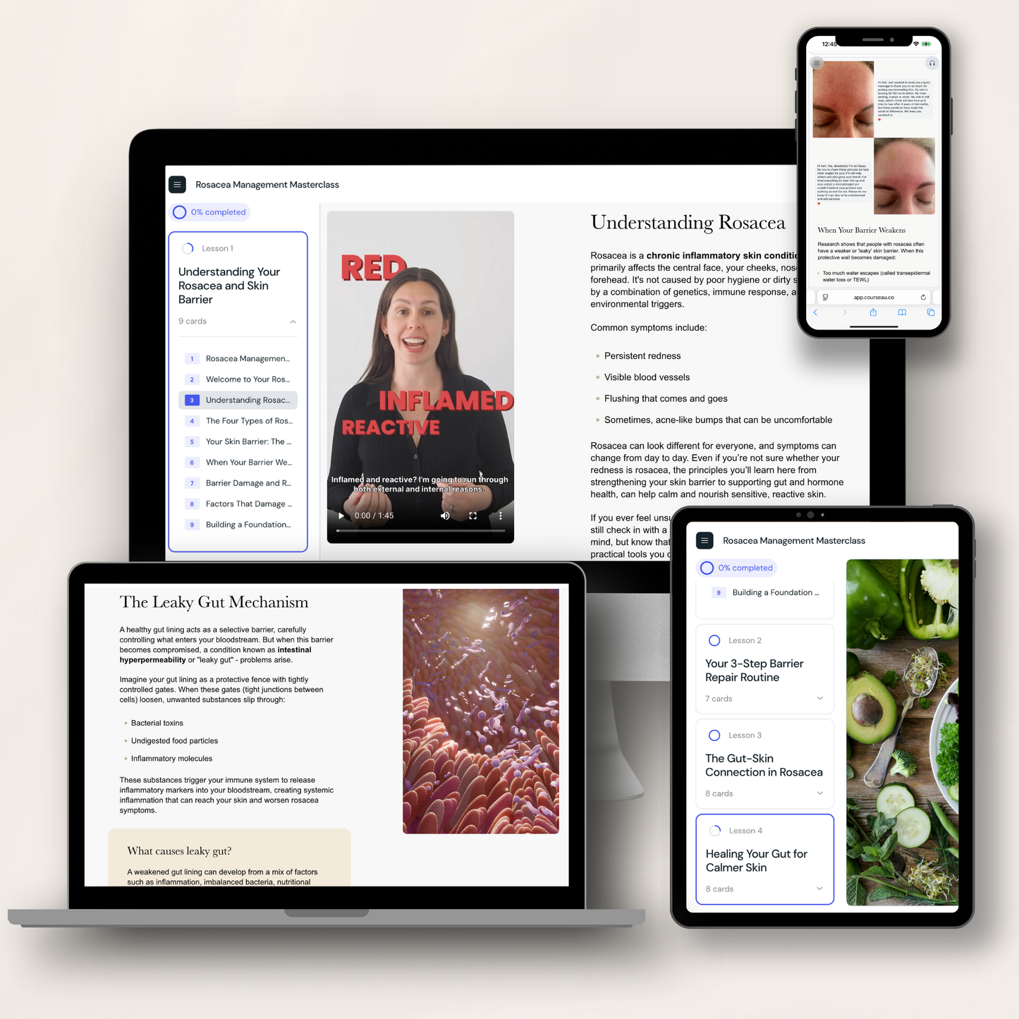 Rosacea Management Masterclass