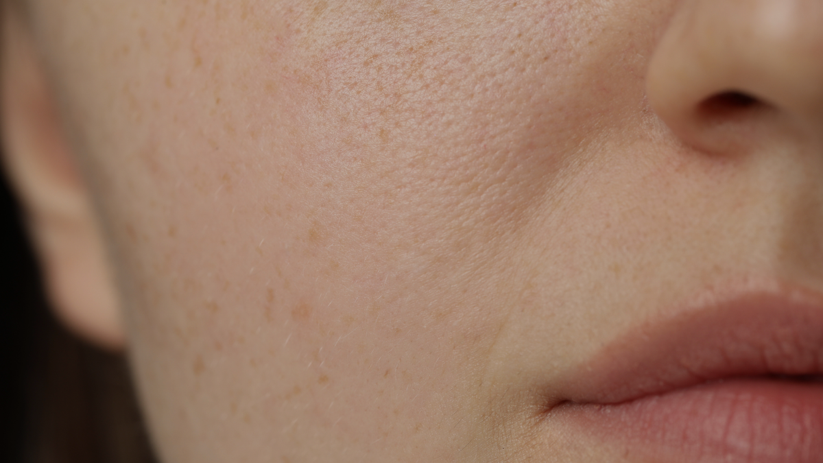 The Skin Barrier