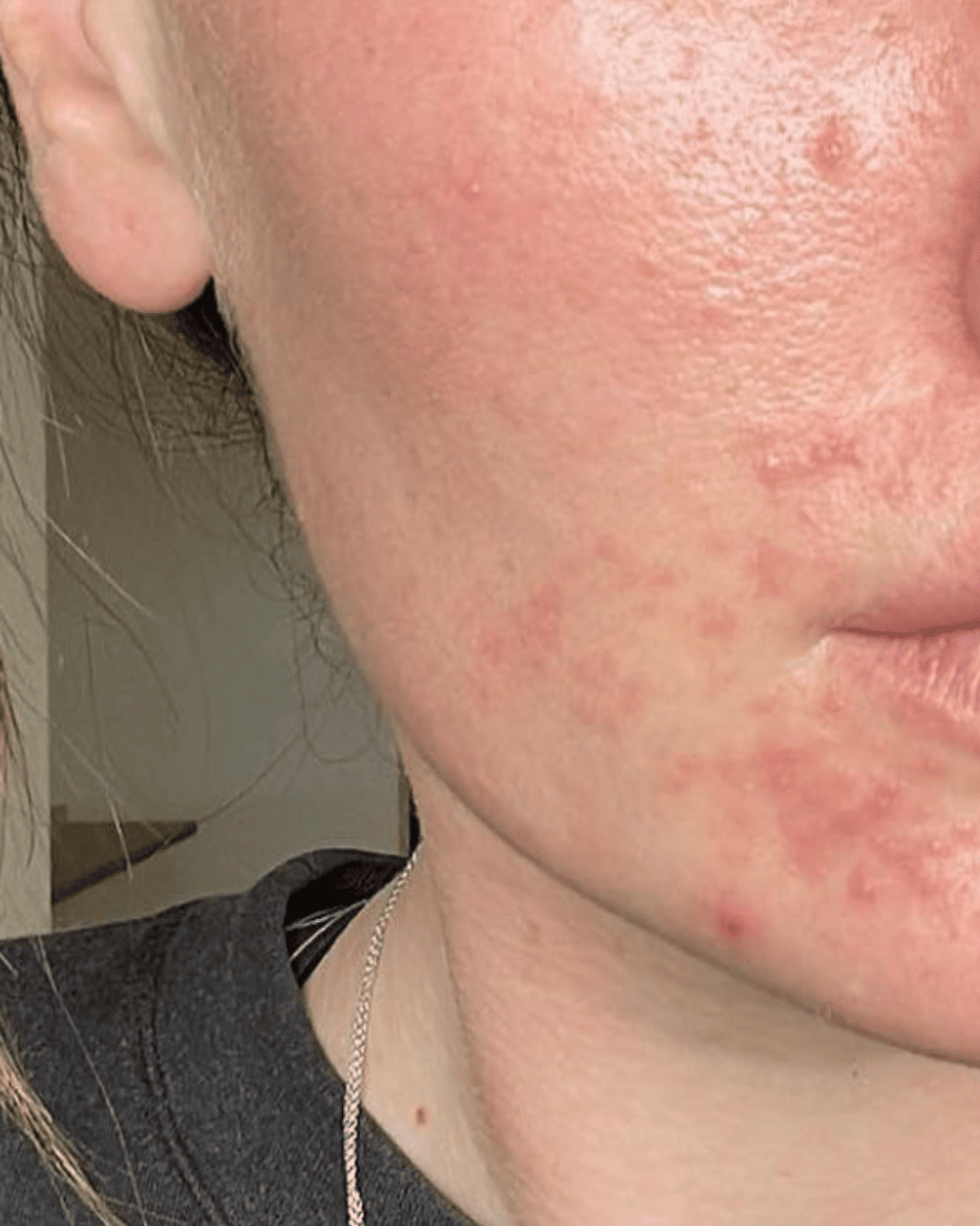 Redness Reeda Redness Repair Set – Vayda Organics
