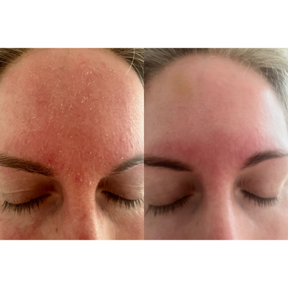 Redness Repair Set