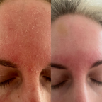 Redness Repair Set