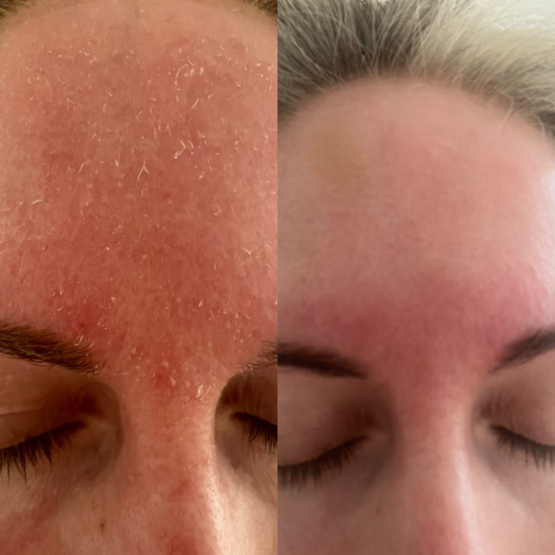 Redness Repair Set